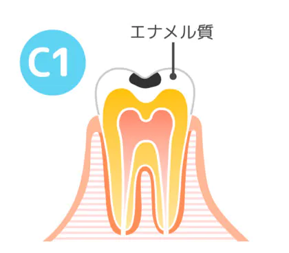 C1│大野城市・下大利駅近くの歯医者・大野城もはら歯科