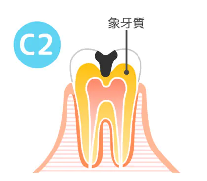 C2│大野城市・下大利駅近くの歯医者・大野城もはら歯科