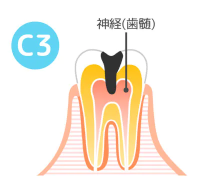 C3│大野城市・下大利駅近くの歯医者・大野城もはら歯科